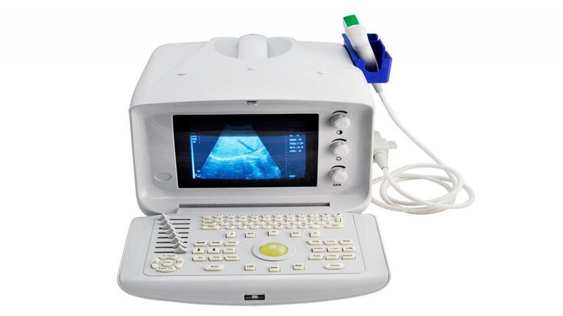 Portable digital ultrasound scanner-4
